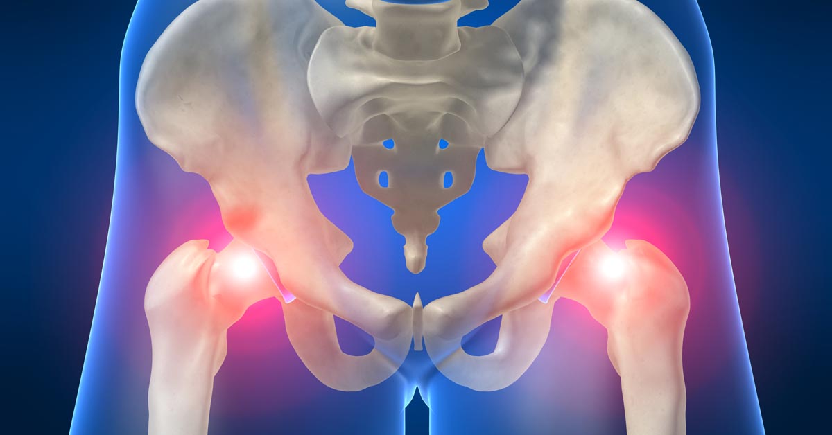 Featured image for Chiropractic Superior for Sciatica Than Surgery