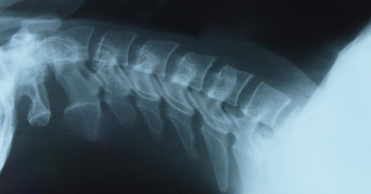 Lincoln Back Pain Treatment without Surgery